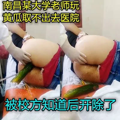 真实南昌一骚女往肛门塞黄瓜无法拔出被送到医院取出